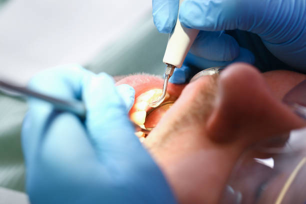Best Urgent Care for Lost Fillings or Crowns in Goldendale, WA