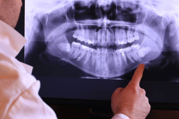 Best Emergency Treatment for Dental Infections or Abscesses in Goldendale, WA